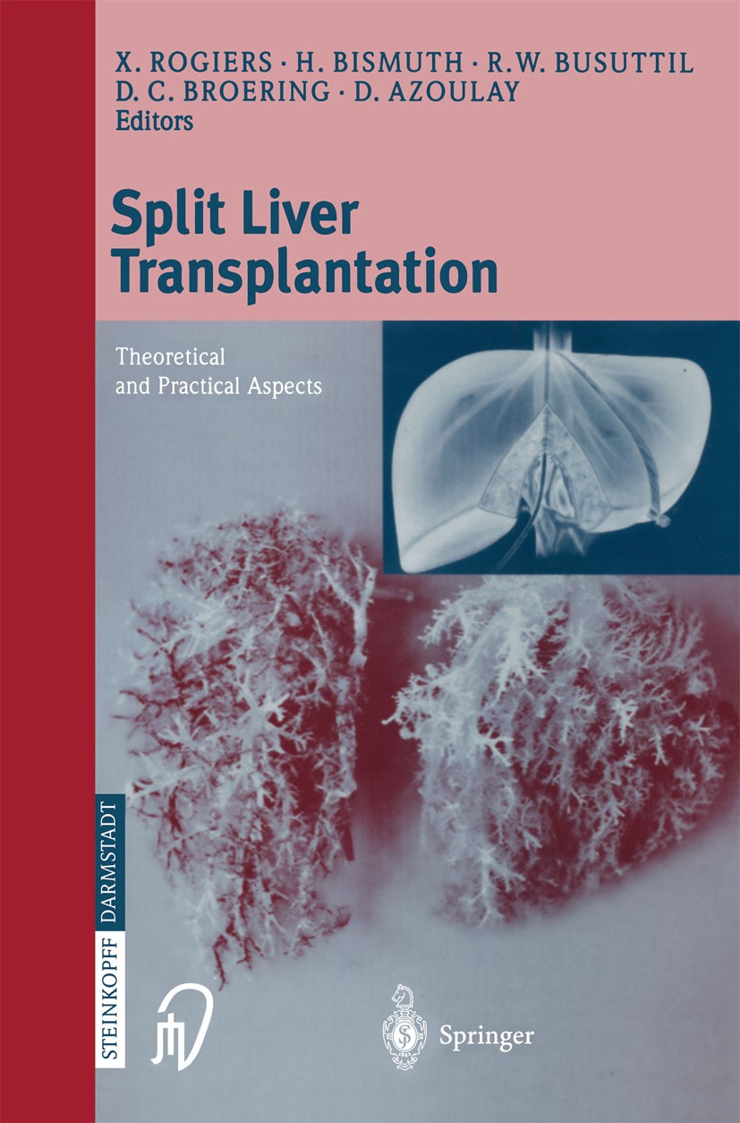 Titlebook: Split liver transplantation; Theoretical and prac Xavier Rogiers,Henri Bismuth,Daniel Azoulay Book 2002 Springer-Verlag Berlin Heidelberg 2 Titlebook: Split liver transplantation; Theoretical and prac Xavier Rogiers,Henri Bismuth,Daniel Azoulay Book 2002 Springer-Verlag Berlin Heidelberg 2