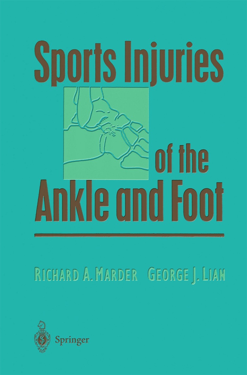 Titlebook: Sports Injuries of the Ankle and Foot; Richard A. Marder,George J. Lian Book 1997 Springer Science+Business Media New York 1997 instabilit Titlebook: Sports Injuries of the Ankle and Foot; Richard A. Marder,George J. Lian Book 1997 Springer Science+Business Media New York 1997 instabilit