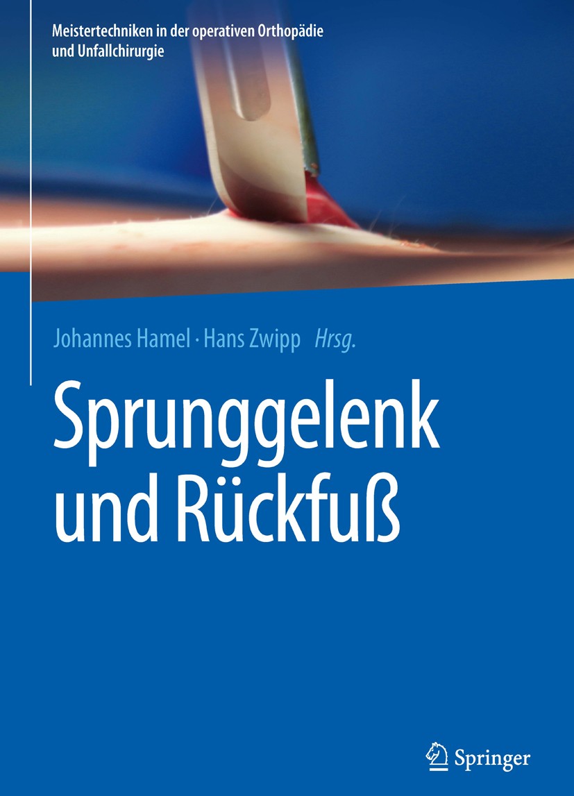 Titlebook: Sprunggelenk und Rückfuß; Johannes Hamel,Hans Zwipp Book 2016 Springer-Verlag Berlin Heidelberg 2016 Fehlverheilte Fibula-Fraktur.Fehlverh Titlebook: Sprunggelenk und Rückfuß; Johannes Hamel,Hans Zwipp Book 2016 Springer-Verlag Berlin Heidelberg 2016 Fehlverheilte Fibula-Fraktur.Fehlverh
