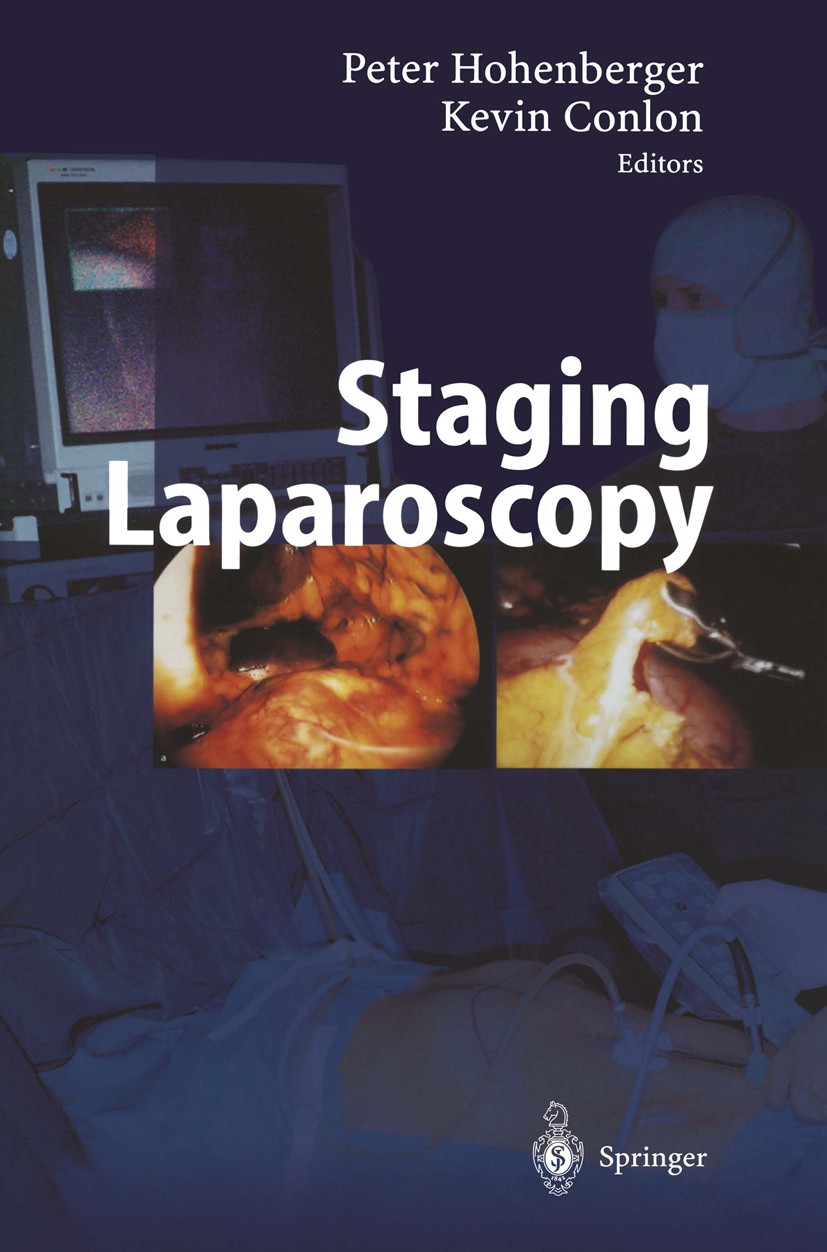 Titlebook: Staging Laparoscopy; Peter Hohenberger,K. Conlon Book 2002 Springer-Verlag Berlin Heidelberg 2002 Abdomen.Gynecologic cancer.Pancreatic ma Titlebook: Staging Laparoscopy; Peter Hohenberger,K. Conlon Book 2002 Springer-Verlag Berlin Heidelberg 2002 Abdomen.Gynecologic cancer.Pancreatic ma