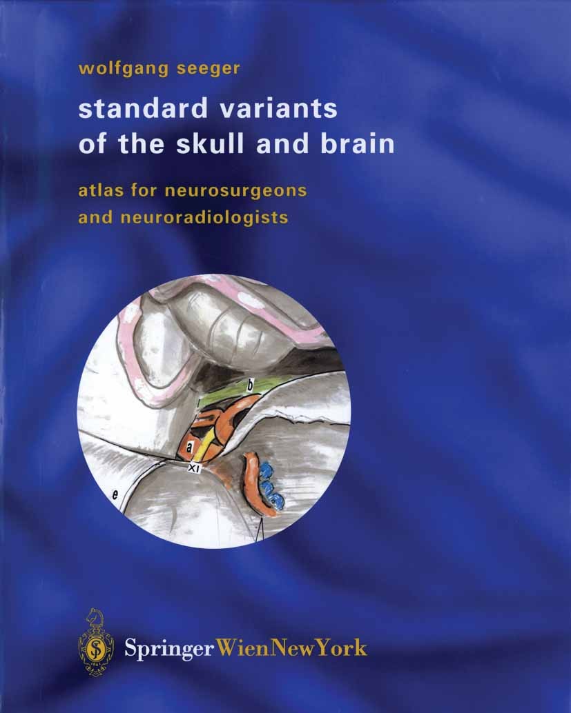 Titlebook: Standard Variants of the Skull and Brain; Atlas for Neurosurge Wolfgang Seeger Book 2003 Springer-Verlag Wien 2003 anatomical variations.an Titlebook: Standard Variants of the Skull and Brain; Atlas for Neurosurge Wolfgang Seeger Book 2003 Springer-Verlag Wien 2003 anatomical variations.an