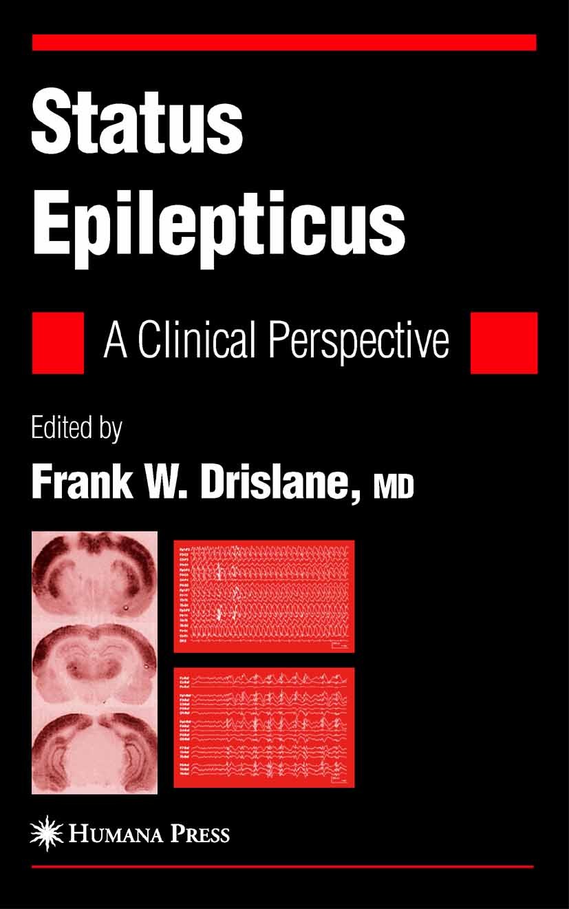 Titlebook: Status Epilepticus; A Clinical Perspecti Frank W. Drislane (Associate Professor of Neurolog Book 20051st edition Humana Press 2005 cognitio Titlebook: Status Epilepticus; A Clinical Perspecti Frank W. Drislane (Associate Professor of Neurolog Book 20051st edition Humana Press 2005 cognitio