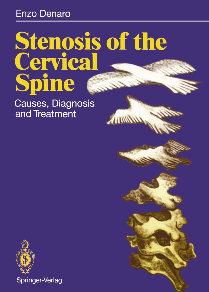 Titlebook: Stenosis of the Cervical Spine; Causes, Diagnosis an Vincenzo Denaro Book 1991 Springer-Verlag Berlin Heidelberg 1991 Instrument.anatomy.bi Titlebook: Stenosis of the Cervical Spine; Causes, Diagnosis an Vincenzo Denaro Book 1991 Springer-Verlag Berlin Heidelberg 1991 Instrument.anatomy.bi
