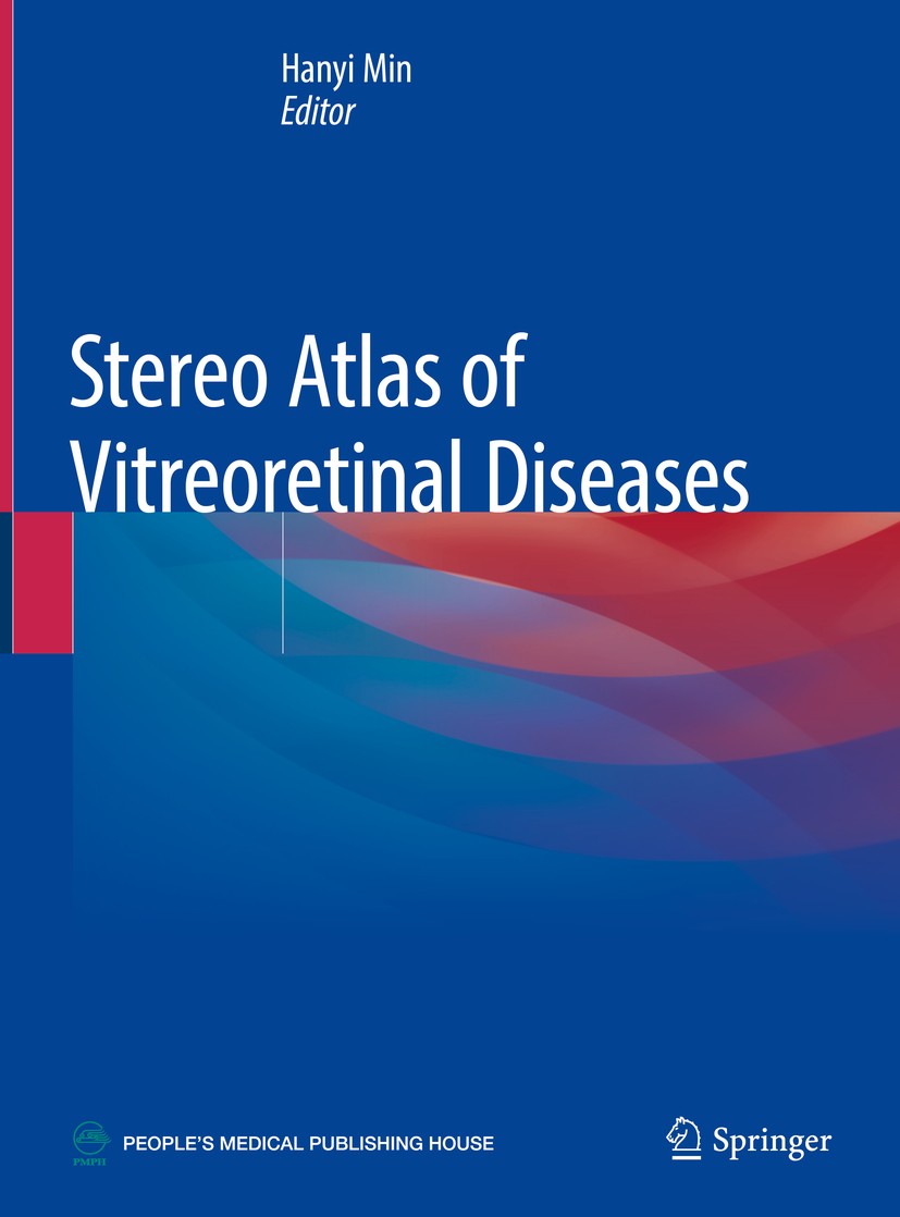 Titlebook: Stereo Atlas of Vitreoretinal Diseases; Hanyi Min Book 2020 Springer Nature Singapore Pte Ltd. and People‘s Medical Publishing House, PR o Titlebook: Stereo Atlas of Vitreoretinal Diseases; Hanyi Min Book 2020 Springer Nature Singapore Pte Ltd. and People‘s Medical Publishing House, PR o