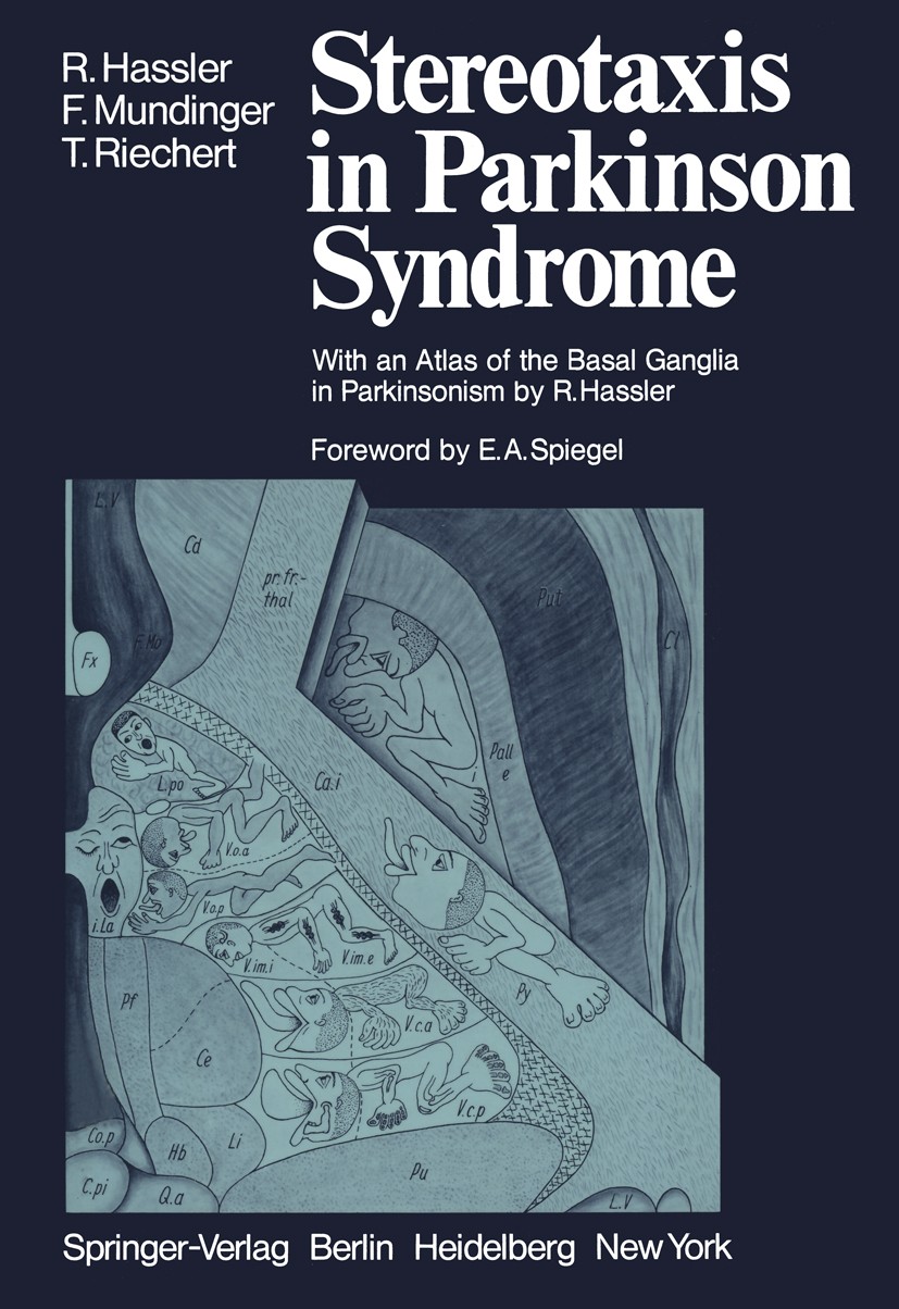 Titlebook: Stereotaxis in Parkinson Syndrome; Clinical-Anatomical Rolf Hassler,Fritz Mundinger,Traugott Riechert Book 1979 Springer-Verlag Berlin-Hei Titlebook: Stereotaxis in Parkinson Syndrome; Clinical-Anatomical Rolf Hassler,Fritz Mundinger,Traugott Riechert Book 1979 Springer-Verlag Berlin-Hei