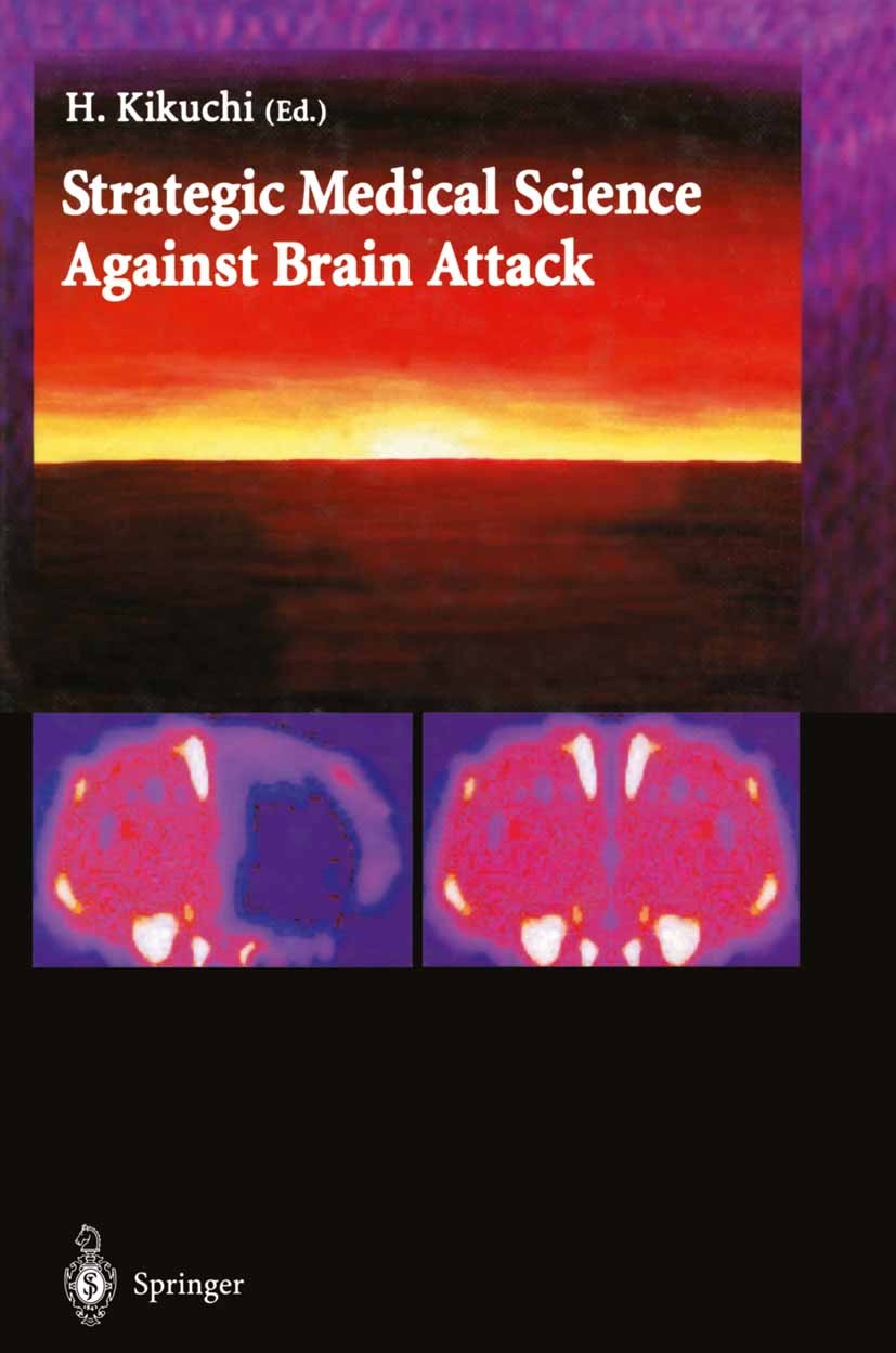 Titlebook: Strategic Medical Science Against Brain Attack; Haruhiko Kikuchi (President Emeritus) Book 2002 Springer-Verlag Tokyo 2002 Brain protectio Titlebook: Strategic Medical Science Against Brain Attack; Haruhiko Kikuchi (President Emeritus) Book 2002 Springer-Verlag Tokyo 2002 Brain protectio