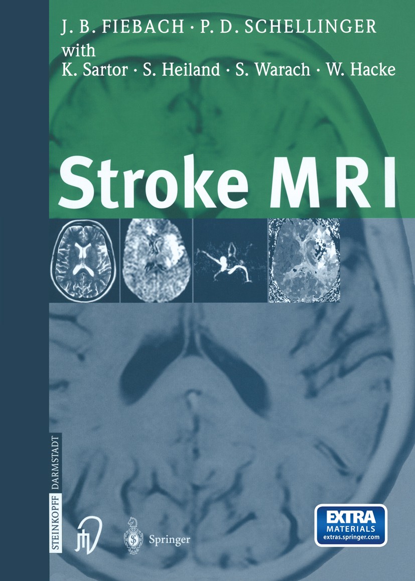 Titlebook: Stroke MRI; Jochen B. Fiebach,Peter D. Schellinger,Werner Hack Book 2003 Springer-Verlag Berlin Heidelberg 2003 MR Angiography.angiography Titlebook: Stroke MRI; Jochen B. Fiebach,Peter D. Schellinger,Werner Hack Book 2003 Springer-Verlag Berlin Heidelberg 2003 MR Angiography.angiography