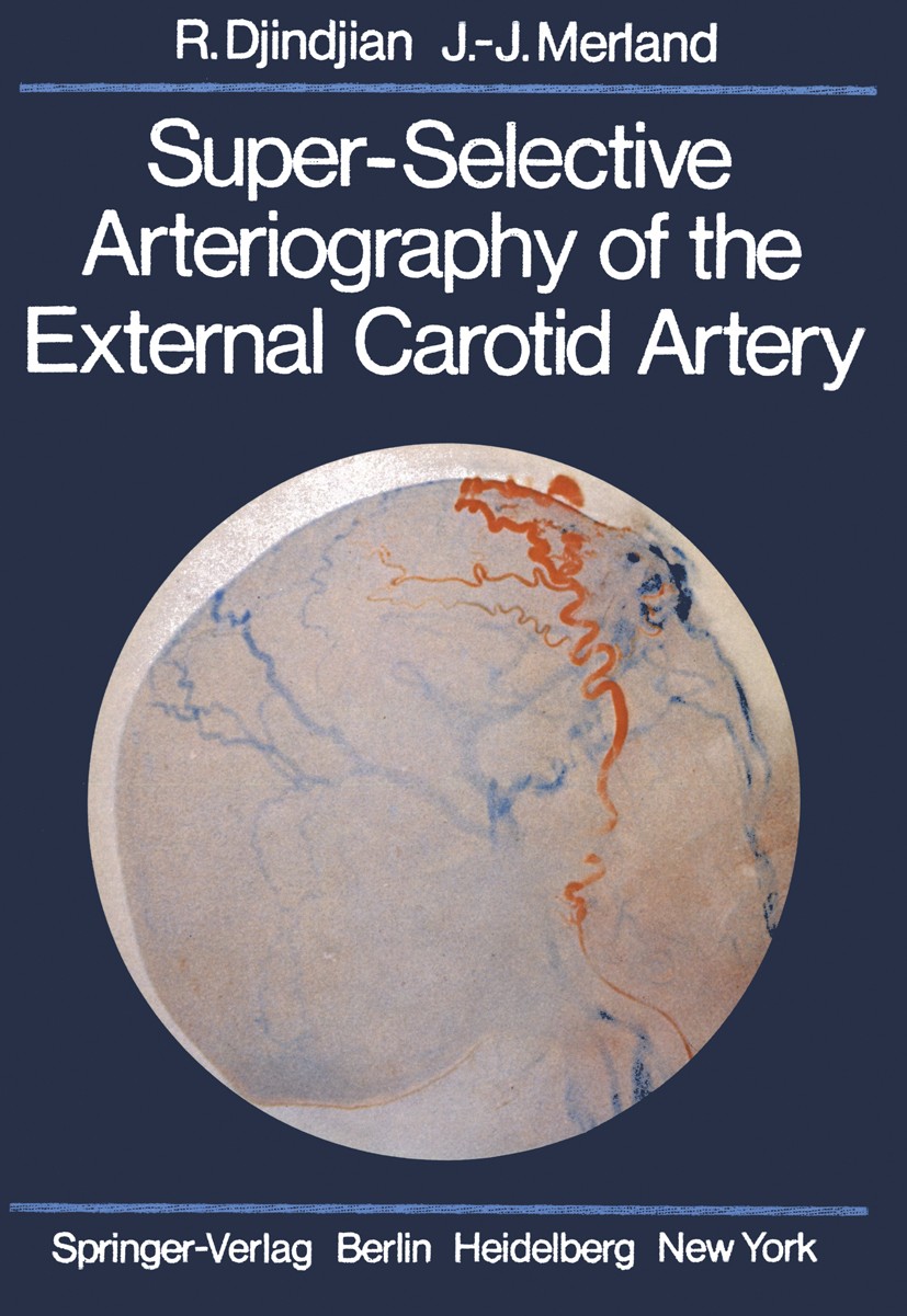 Titlebook: Super-Selective Arteriography of the External Carotid Artery; René Djindjian,Jean-Jacques Merland Book 1978 Springer-Verlag Berlin · Heide Titlebook: Super-Selective Arteriography of the External Carotid Artery; René Djindjian,Jean-Jacques Merland Book 1978 Springer-Verlag Berlin · Heide