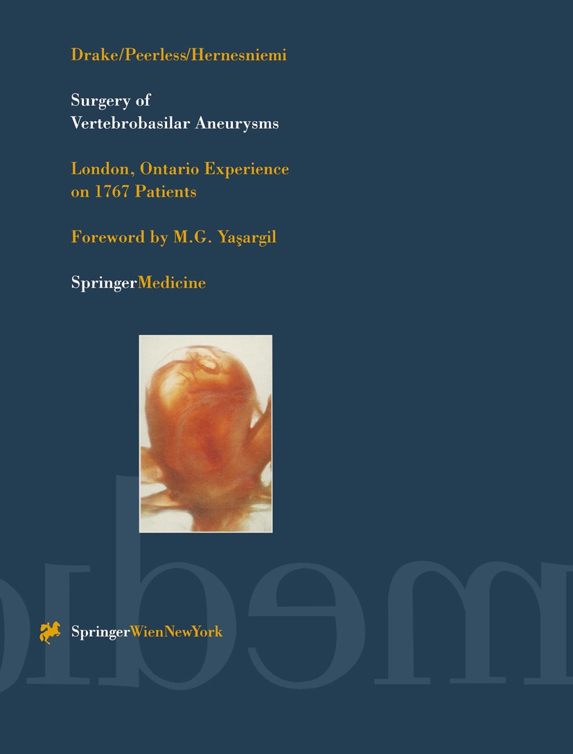 Titlebook: Surgery of Vertebrobasilar Aneurysms; London, Ontario Expe Charles G. Drake,Sydney J. Peerless,Juha A. Hernes Book 1996 Springer-Verlag/Wie Titlebook: Surgery of Vertebrobasilar Aneurysms; London, Ontario Expe Charles G. Drake,Sydney J. Peerless,Juha A. Hernes Book 1996 Springer-Verlag/Wie