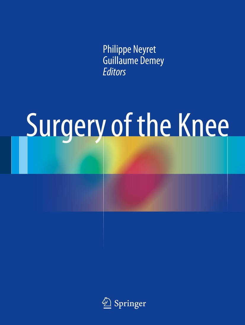 Titlebook: Surgery of the Knee; Philippe Neyret,Guillaume Demey Book 20141st edition The Editor(s) (if applicable) and The Author(s) 2014 Knee.Orthop Titlebook: Surgery of the Knee; Philippe Neyret,Guillaume Demey Book 20141st edition The Editor(s) (if applicable) and The Author(s) 2014 Knee.Orthop