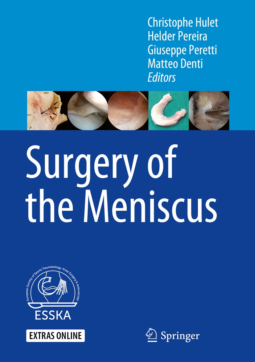 Titlebook: Surgery of the Meniscus; Christophe Hulet,Helder Pereira,Matteo Denti Book 2016 Springer-Verlag GmbH Germany, part of Springer Nature 2016 Titlebook: Surgery of the Meniscus; Christophe Hulet,Helder Pereira,Matteo Denti Book 2016 Springer-Verlag GmbH Germany, part of Springer Nature 2016