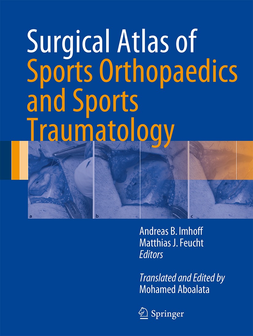Titlebook: Surgical Atlas of Sports Orthopaedics and Sports Traumatology; Andreas B. Imhoff,Matthias J. Feucht Book 2015 Springer-Verlag Berlin Heide Titlebook: Surgical Atlas of Sports Orthopaedics and Sports Traumatology; Andreas B. Imhoff,Matthias J. Feucht Book 2015 Springer-Verlag Berlin Heide