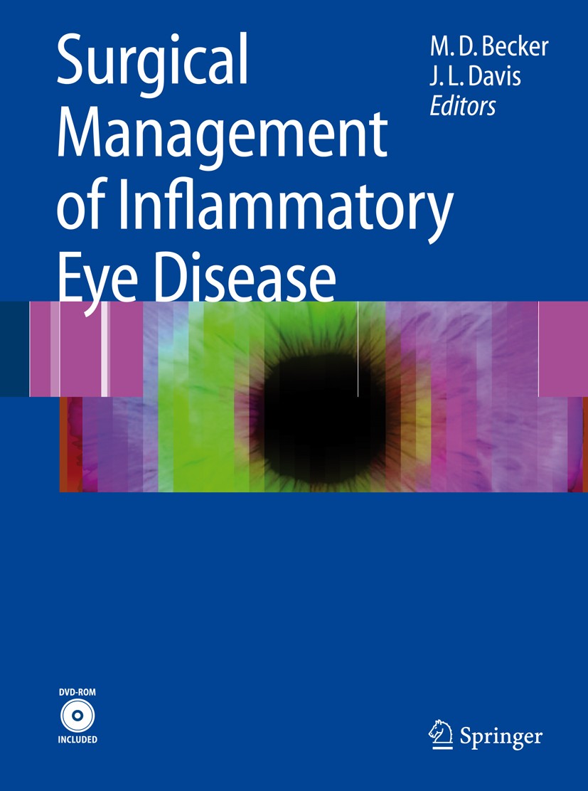 Titlebook: Surgical Management of Inflammatory Eye Disease; Matthias Becker,Janet Davis Book 2008 Springer-Verlag Berlin Heidelberg 2008 Cryotherapy. Titlebook: Surgical Management of Inflammatory Eye Disease; Matthias Becker,Janet Davis Book 2008 Springer-Verlag Berlin Heidelberg 2008 Cryotherapy.