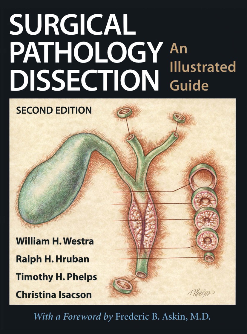 Titlebook: Surgical Pathology Dissection; An Illustrated Guide William H. Westra,Timothy H. Phelps,Christina Isac Book 2003Latest edition Springer Sci Titlebook: Surgical Pathology Dissection; An Illustrated Guide William H. Westra,Timothy H. Phelps,Christina Isac Book 2003Latest edition Springer Sci