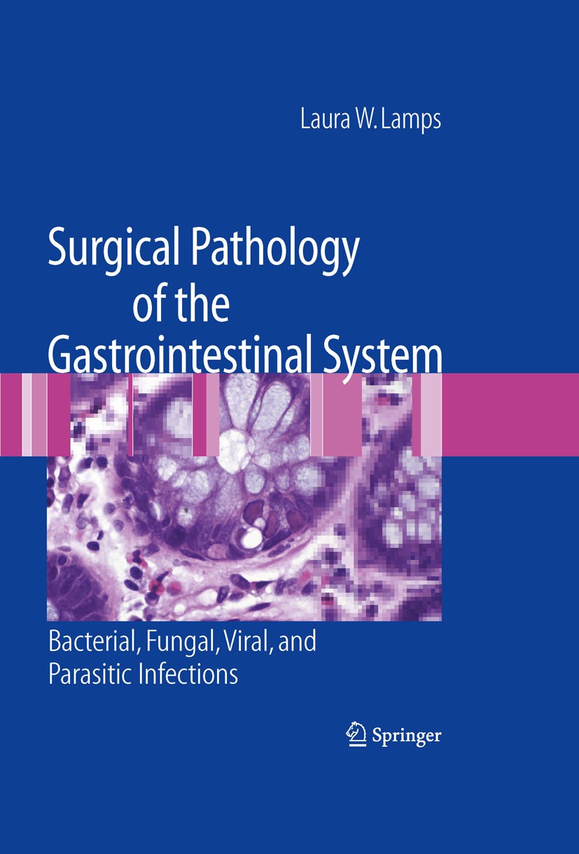Titlebook: Surgical Pathology of the Gastrointestinal System: Bacterial, Fungal, Viral, and Parasitic Infection; Laura W. Lamps Book 2010 Springer-Ve Titlebook: Surgical Pathology of the Gastrointestinal System: Bacterial, Fungal, Viral, and Parasitic Infection; Laura W. Lamps Book 2010 Springer-Ve