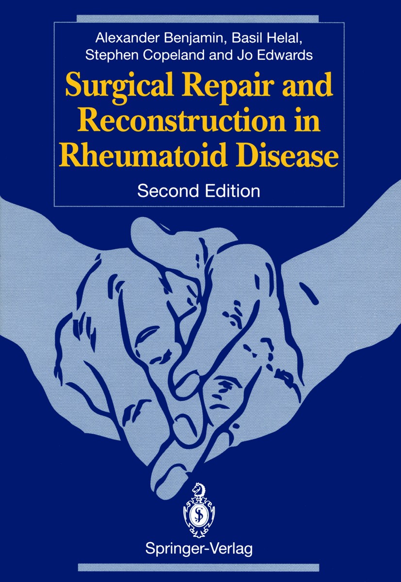 Titlebook: Surgical Repair and Reconstruction in Rheumatoid Disease; Alexander Benjamin,Basil Helal,Jo C. W. Edwards Book 1993Latest edition Springer Titlebook: Surgical Repair and Reconstruction in Rheumatoid Disease; Alexander Benjamin,Basil Helal,Jo C. W. Edwards Book 1993Latest edition Springer