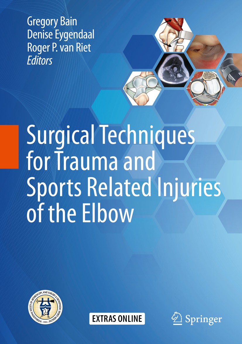 Titlebook: Surgical Techniques for Trauma and Sports Related Injuries of the Elbow; Gregory Bain,Denise Eygendaal,Roger P. van Riet Book 2020 ISAKOS Titlebook: Surgical Techniques for Trauma and Sports Related Injuries of the Elbow; Gregory Bain,Denise Eygendaal,Roger P. van Riet Book 2020 ISAKOS