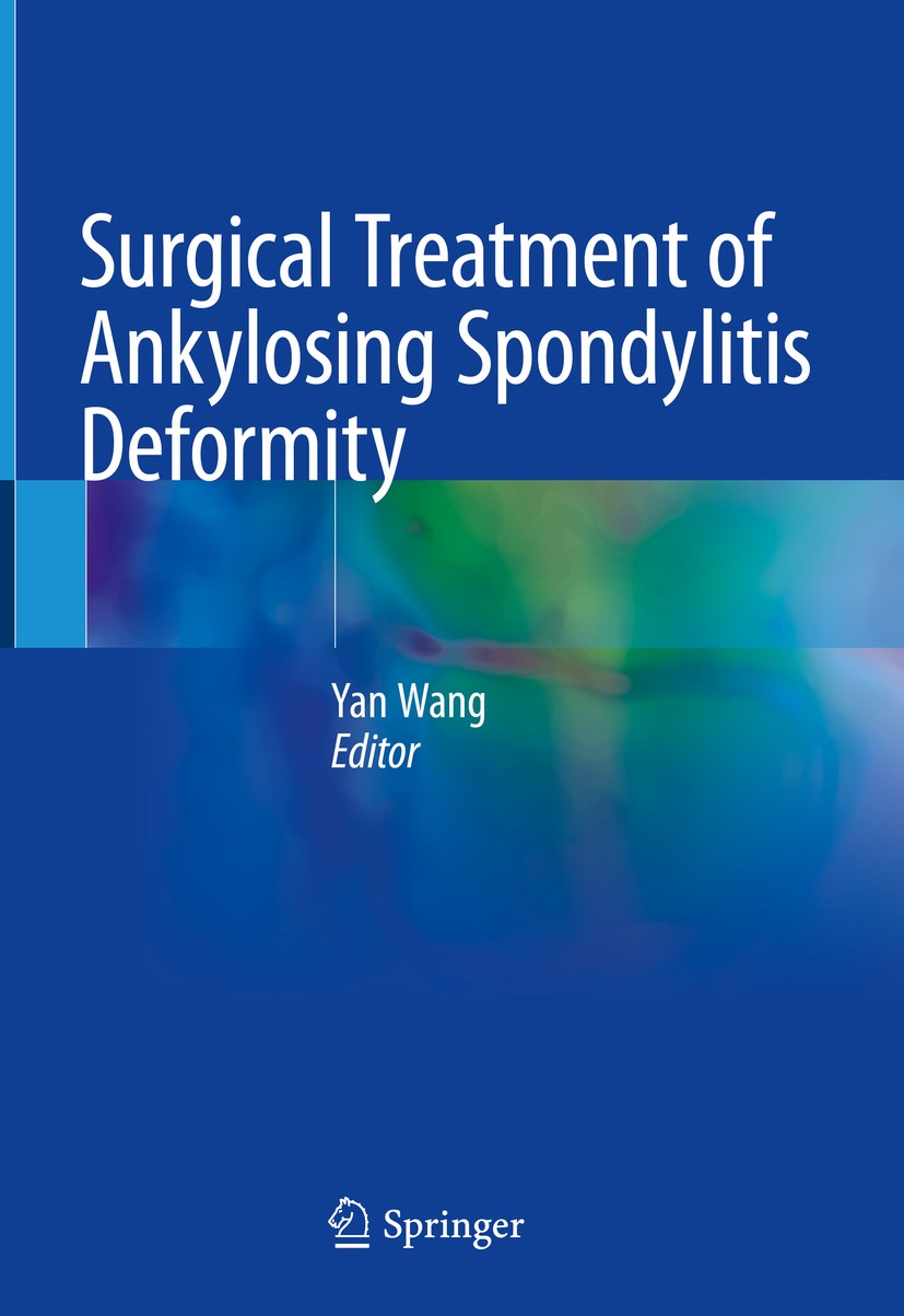 Titlebook: Surgical Treatment of Ankylosing Spondylitis Deformity; Yan Wang Book 2019 Springer Nature Singapore Pte Ltd. 2019 ankylosing spondylitis. Titlebook: Surgical Treatment of Ankylosing Spondylitis Deformity; Yan Wang Book 2019 Springer Nature Singapore Pte Ltd. 2019 ankylosing spondylitis.