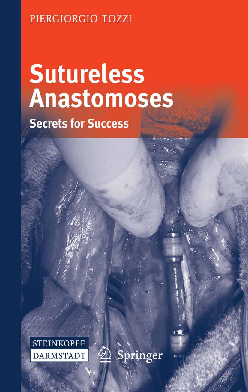 Titlebook: Sutureless Anastomoses; Secrets for Success Piergiorgio Tozzi Book 2007 Steinkopff-Verlag Darmstadt 2007 anostomotic devices.assessment.bio Titlebook: Sutureless Anastomoses; Secrets for Success Piergiorgio Tozzi Book 2007 Steinkopff-Verlag Darmstadt 2007 anostomotic devices.assessment.bio