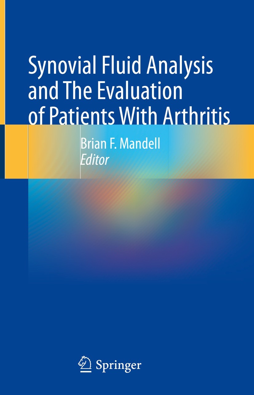 Titlebook: Synovial Fluid Analysis and The Evaluation of Patients With Arthritis; Brian F. Mandell Textbook 2022 The Editor(s) (if applicable) and Th Titlebook: Synovial Fluid Analysis and The Evaluation of Patients With Arthritis; Brian F. Mandell Textbook 2022 The Editor(s) (if applicable) and Th