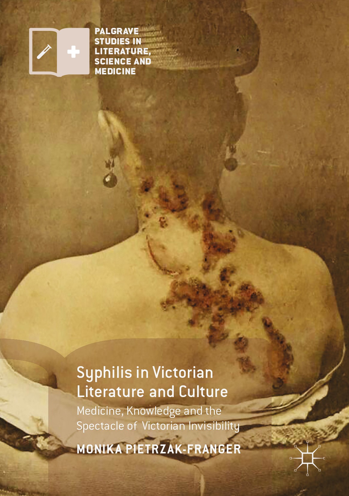 Titlebook: Syphilis in Victorian Literature and Culture; Medicine, Knowledge Monika Pietrzak-Franger Book 2017 The Editor(s) (if applicable) and The Titlebook: Syphilis in Victorian Literature and Culture; Medicine, Knowledge Monika Pietrzak-Franger Book 2017 The Editor(s) (if applicable) and The