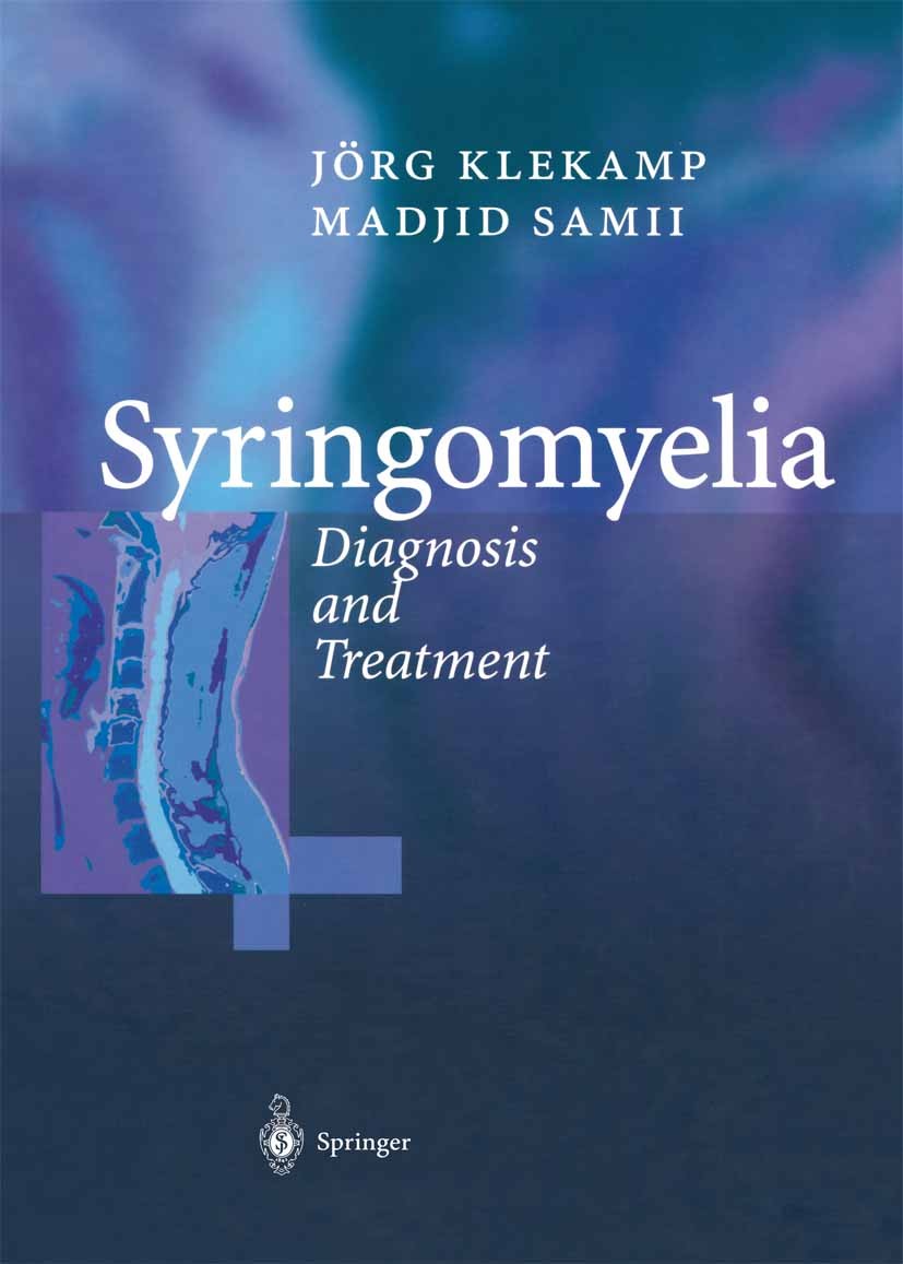 Titlebook: Syringomyelia; Diagnosis and Treatm Jörg Klekamp,Madjid Samii Book 2002 Springer-Verlag Berlin Heidelberg 2002 Chiara malformation.Syringom Titlebook: Syringomyelia; Diagnosis and Treatm Jörg Klekamp,Madjid Samii Book 2002 Springer-Verlag Berlin Heidelberg 2002 Chiara malformation.Syringom