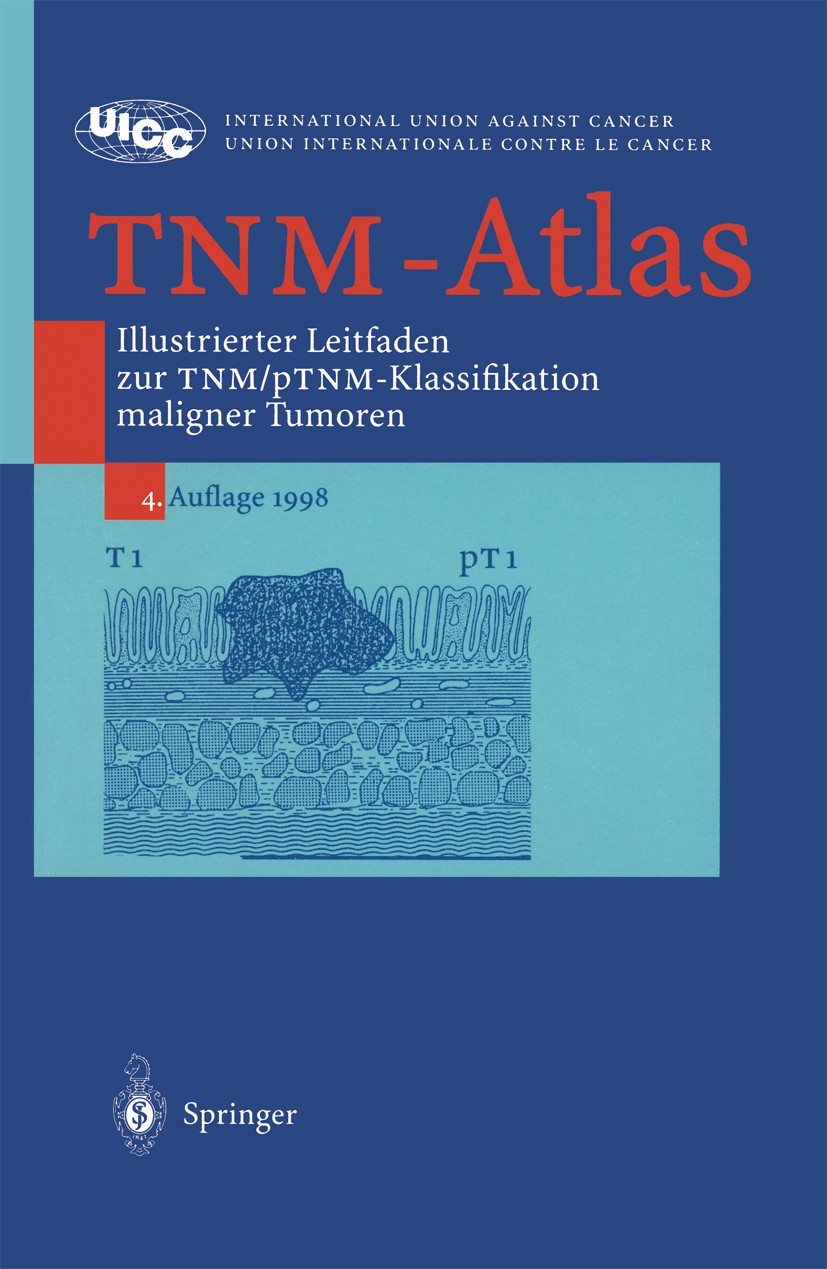 Titlebook: TNM-Atlas; Illustrierter Leitfa P. Hermanek (Vorstand),R. V. P. Hutter (Clinical P Book 19984th edition Springer-Verlag Berlin Heidelberg 1 Titlebook: TNM-Atlas; Illustrierter Leitfa P. Hermanek (Vorstand),R. V. P. Hutter (Clinical P Book 19984th edition Springer-Verlag Berlin Heidelberg 1