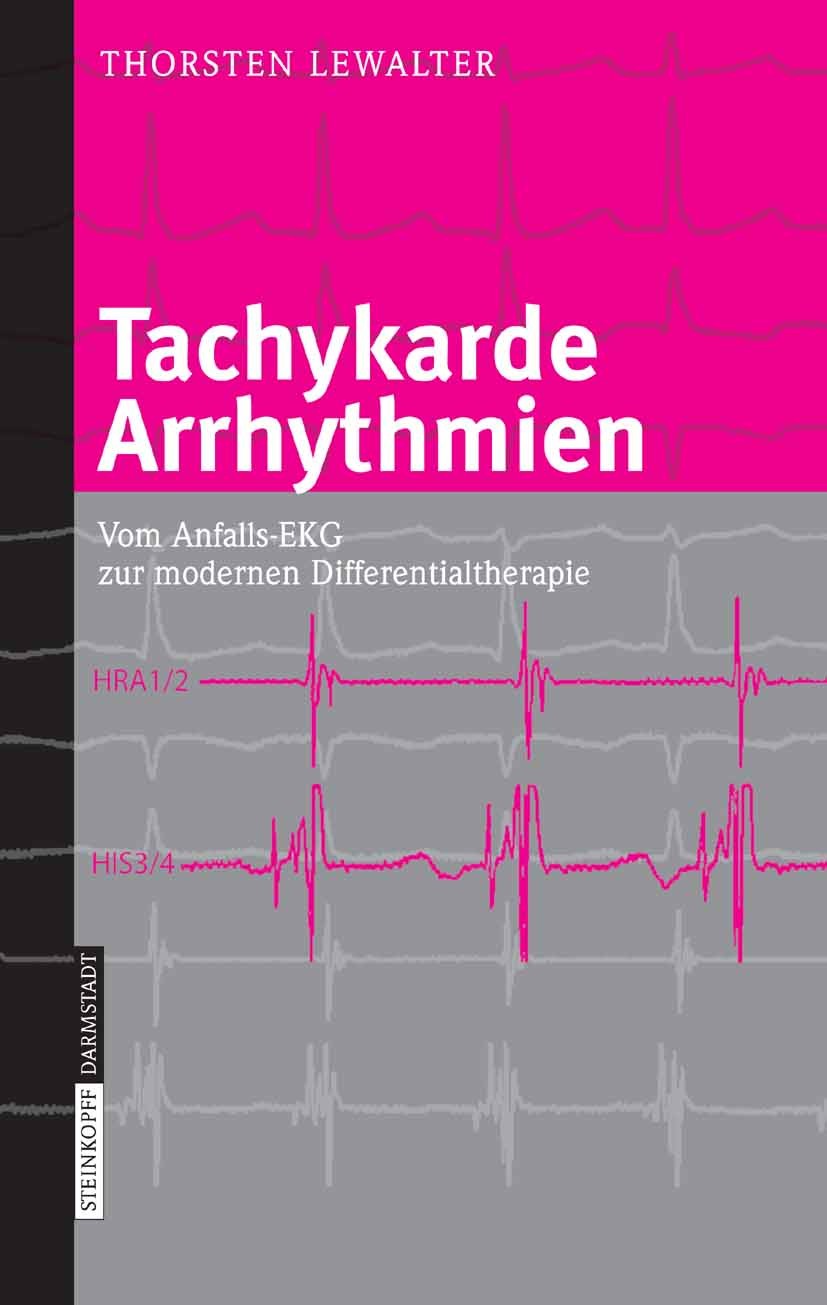 Titlebook: Tachykarde Arrhythmien; Vom Anfalls-EKG zur Thorsten Lewalter Book 2007 Steinkopff-Verlag Darmstadt 2007 Arrhythmie.Diagnostik.EKG-Diagnos Titlebook: Tachykarde Arrhythmien; Vom Anfalls-EKG zur Thorsten Lewalter Book 2007 Steinkopff-Verlag Darmstadt 2007 Arrhythmie.Diagnostik.EKG-Diagnos