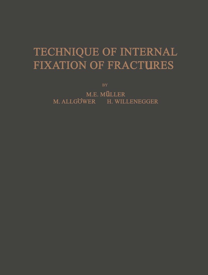 Titlebook: Technique of Internal Fixation of Fractures; M. E. Müller,M. Allgöwer,H. Willenegger Book 1965 Springer-Verlag, Berlin · Heidelberg 1965 B Titlebook: Technique of Internal Fixation of Fractures; M. E. Müller,M. Allgöwer,H. Willenegger Book 1965 Springer-Verlag, Berlin · Heidelberg 1965 B