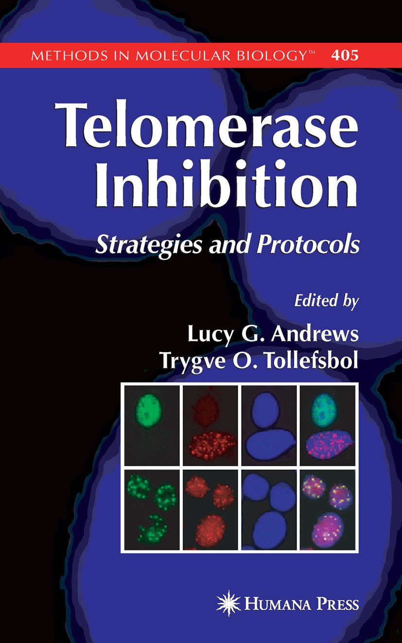 Titlebook: Telomerase Inhibition; Strategies and Proto Lucy G. Andrews,Trygve O. Tollefsbol Book 2007 Humana Press 2007 Endoplasmatisches Reticulum.Nu Titlebook: Telomerase Inhibition; Strategies and Proto Lucy G. Andrews,Trygve O. Tollefsbol Book 2007 Humana Press 2007 Endoplasmatisches Reticulum.Nu