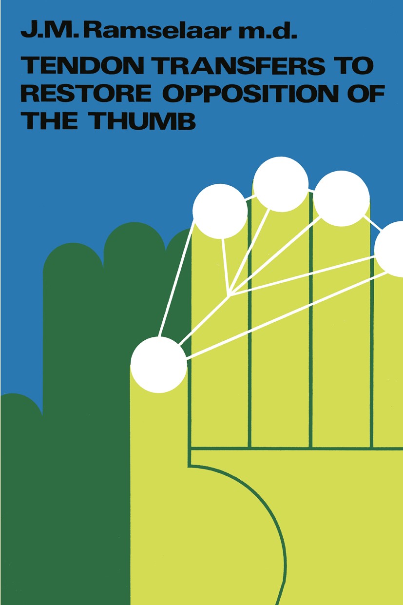 Titlebook: Tendon Transfers to Restore Opposition of the Thumb; J. M. Ramselaar Book 1970 H. E. Stenfert Kroese N.V. | Leiden 1970 anatomy.hand.joint Titlebook: Tendon Transfers to Restore Opposition of the Thumb; J. M. Ramselaar Book 1970 H. E. Stenfert Kroese N.V. | Leiden 1970 anatomy.hand.joint