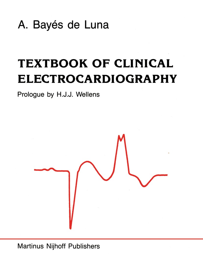 Titlebook: Textbook of Clinical Electrocardiography; A. Bayés Luna Book 1987 Martinus Nijhoff Publishers 1987 anesthesia.aneurysm.atrial fibrillation Titlebook: Textbook of Clinical Electrocardiography; A. Bayés Luna Book 1987 Martinus Nijhoff Publishers 1987 anesthesia.aneurysm.atrial fibrillation