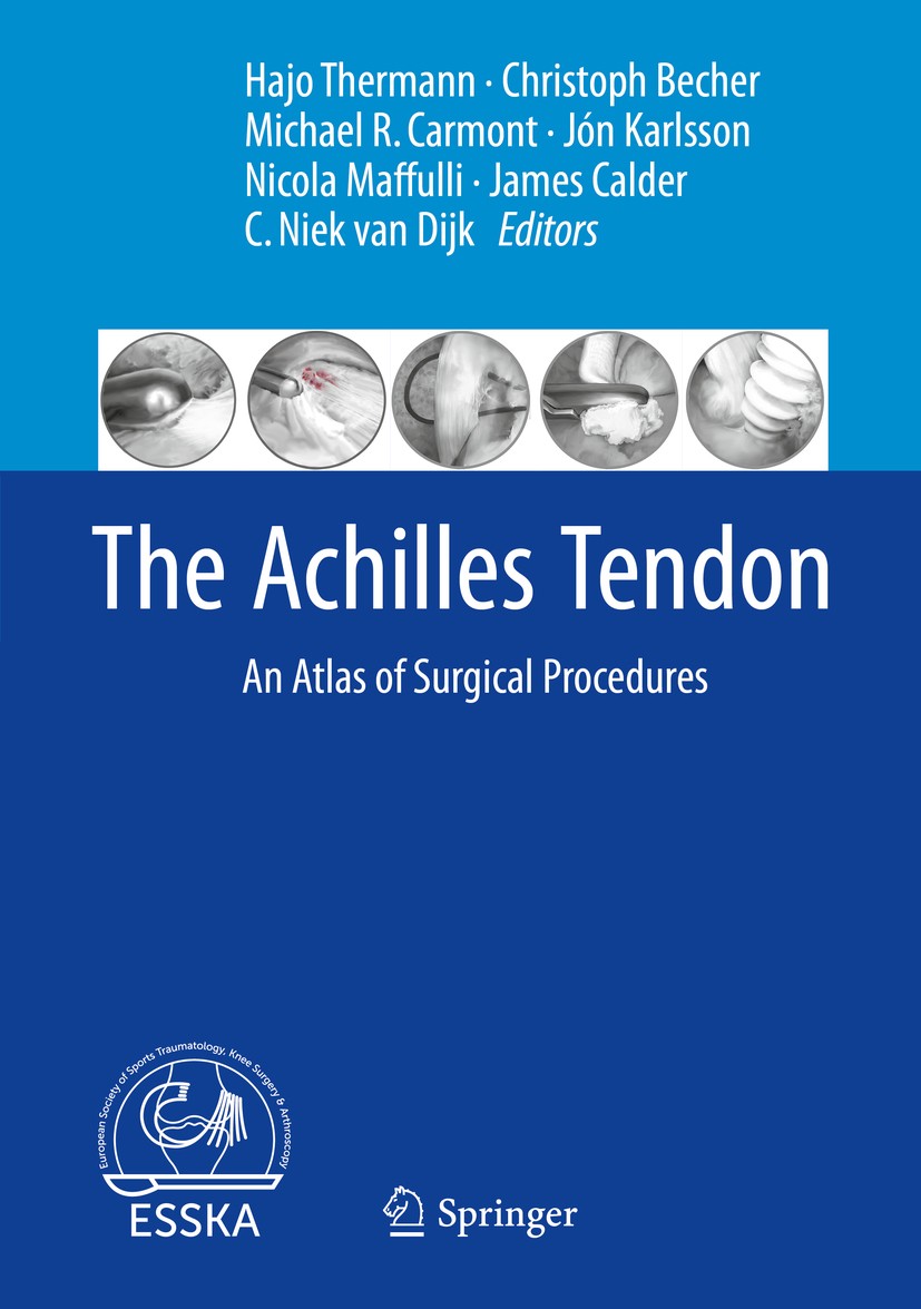 Titlebook: The Achilles Tendon; An Atlas of Surgical Hajo Thermann,Christoph Becher,C. Niek van Dijk Book 2017 Crown 2017 Foot.Ankle.Podiatry.Treatmen Titlebook: The Achilles Tendon; An Atlas of Surgical Hajo Thermann,Christoph Becher,C. Niek van Dijk Book 2017 Crown 2017 Foot.Ankle.Podiatry.Treatmen