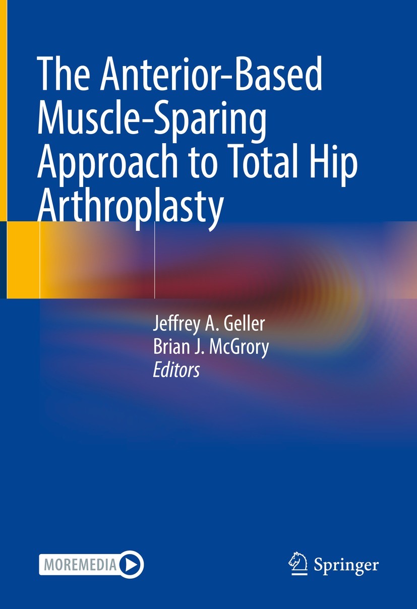 Titlebook: The Anterior-Based Muscle-Sparing Approach to Total Hip Arthroplasty; Jeffrey A. Geller,Brian J. McGrory Book 2022 The Editor(s) (if appli Titlebook: The Anterior-Based Muscle-Sparing Approach to Total Hip Arthroplasty; Jeffrey A. Geller,Brian J. McGrory Book 2022 The Editor(s) (if appli