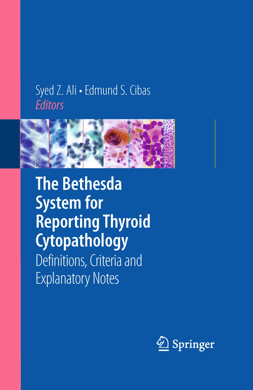 Titlebook: The Bethesda System for Reporting Thyroid Cytopathology; Definitions, Criteri Syed Z. Ali,Edmund S. Cibas Book 20101st edition Springer Sci Titlebook: The Bethesda System for Reporting Thyroid Cytopathology; Definitions, Criteri Syed Z. Ali,Edmund S. Cibas Book 20101st edition Springer Sci