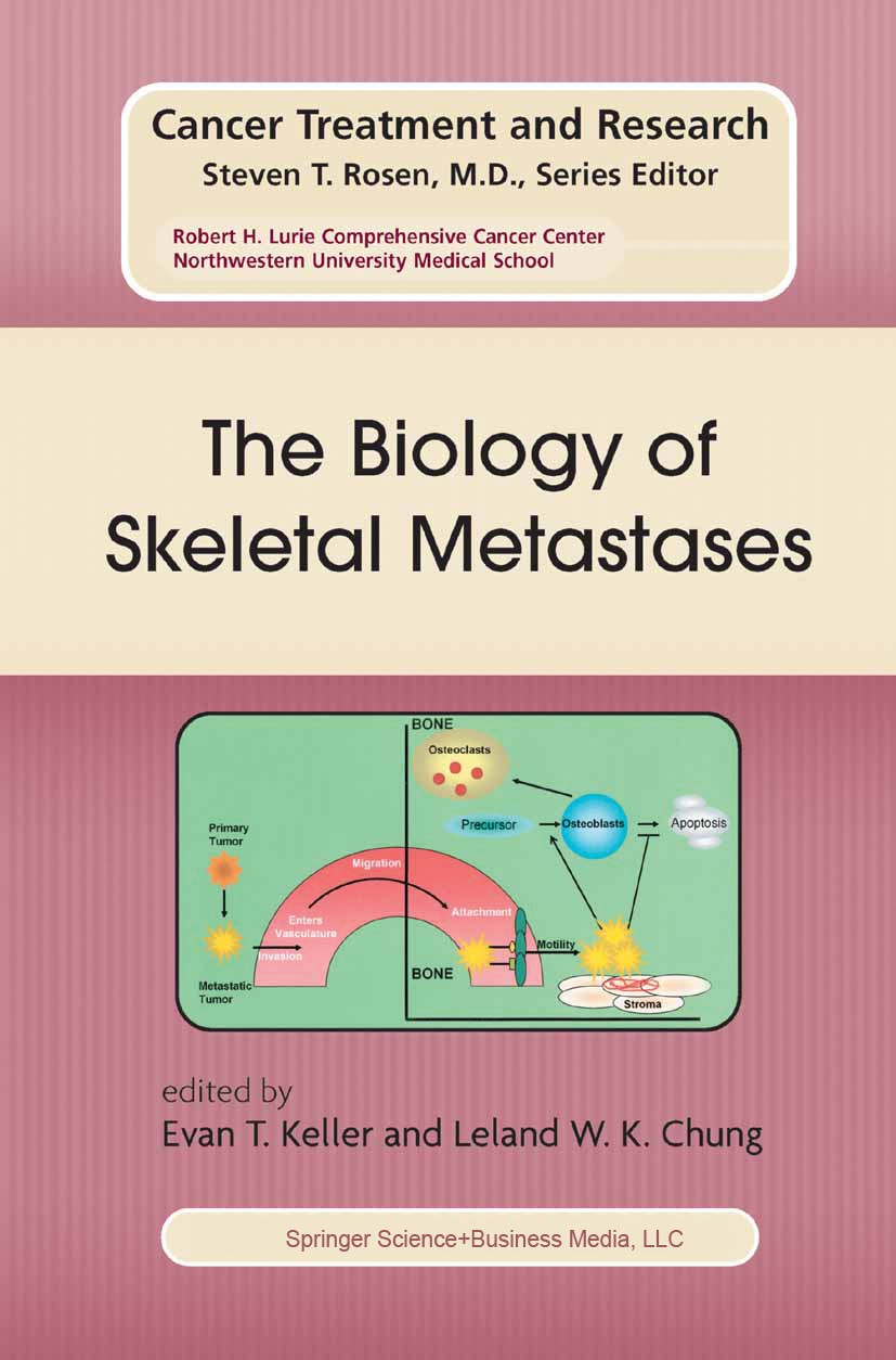 Titlebook: The Biology of Skeletal Metastases; Evan T. Keller (Associate Professor of Urology, Co Book 2004 Springer Science+Business Media New York Titlebook: The Biology of Skeletal Metastases; Evan T. Keller (Associate Professor of Urology, Co Book 2004 Springer Science+Business Media New York