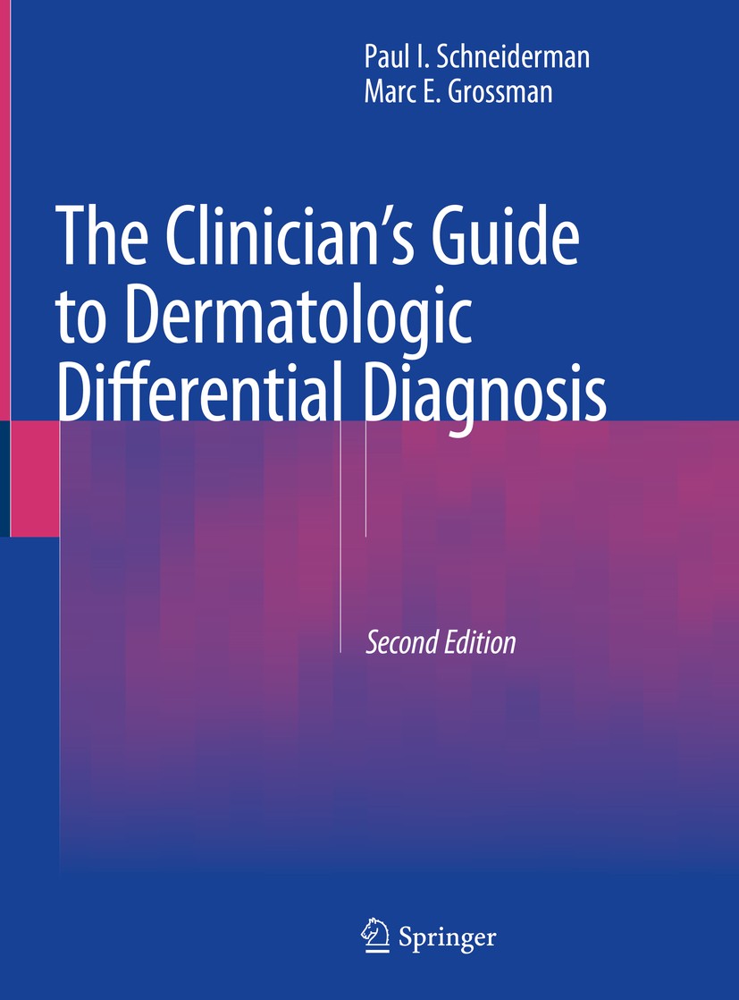 Titlebook: The Clinician‘s Guide to Dermatologic Differential Diagnosis; Paul I. Schneiderman,Marc E. Grossman Book 2022Latest edition Springer Natur Titlebook: The Clinician‘s Guide to Dermatologic Differential Diagnosis; Paul I. Schneiderman,Marc E. Grossman Book 2022Latest edition Springer Natur
