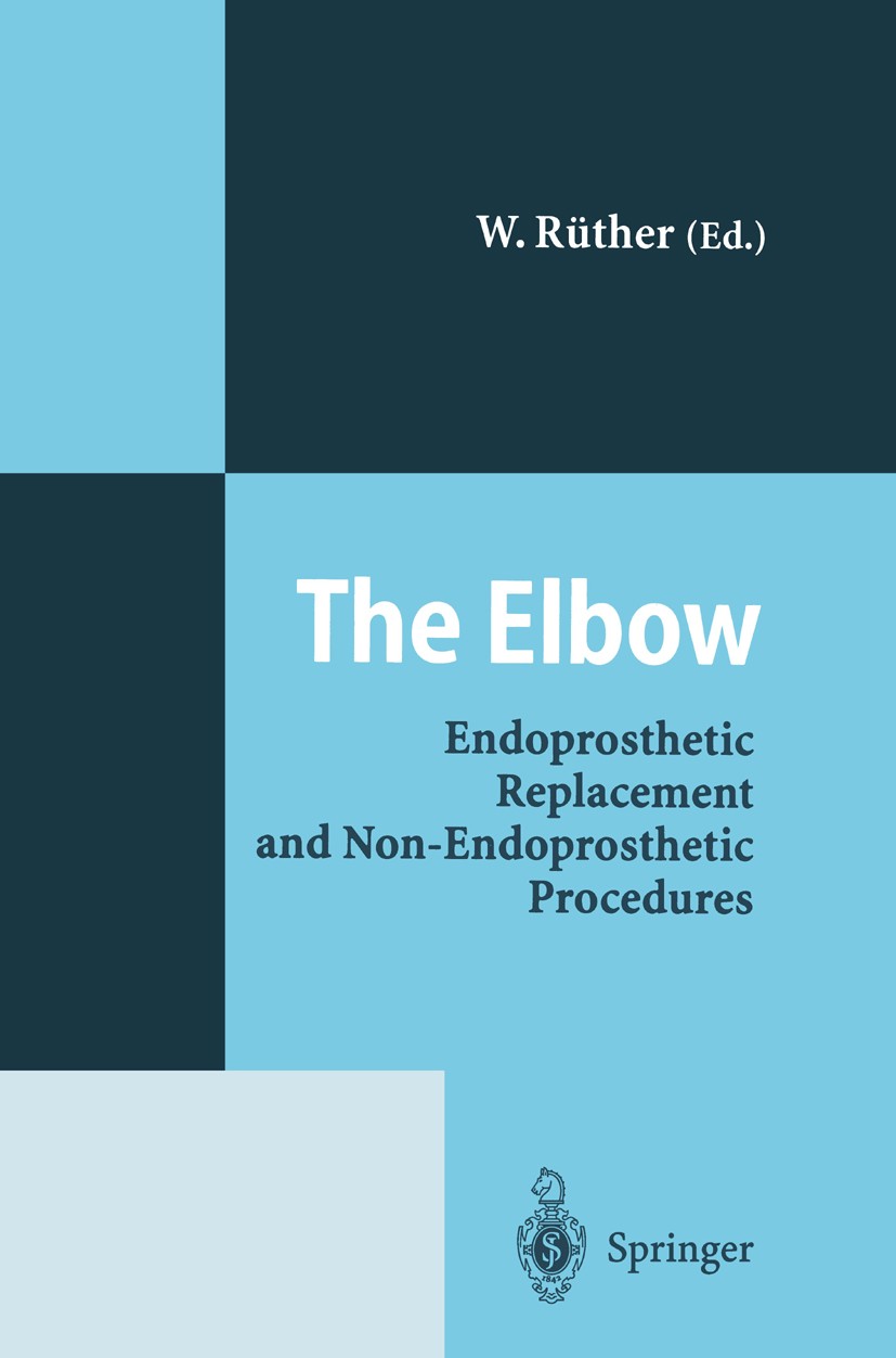 Titlebook: The Elbow; Endoprosthetic Repla W. Rüther Conference proceedings 1996 Springer-Verlag Berlin Heidelberg 1996 Ellenbogen.anatomy.arthroplast Titlebook: The Elbow; Endoprosthetic Repla W. Rüther Conference proceedings 1996 Springer-Verlag Berlin Heidelberg 1996 Ellenbogen.anatomy.arthroplast
