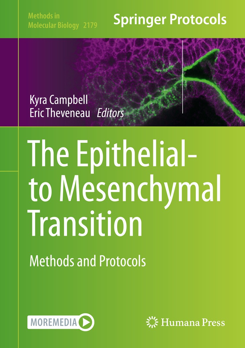 Titlebook: The Epithelial-to Mesenchymal Transition; Methods and Protocol Kyra Campbell,Eric Theveneau Book 2021 Springer Science+Business Media, LLC, Titlebook: The Epithelial-to Mesenchymal Transition; Methods and Protocol Kyra Campbell,Eric Theveneau Book 2021 Springer Science+Business Media, LLC,