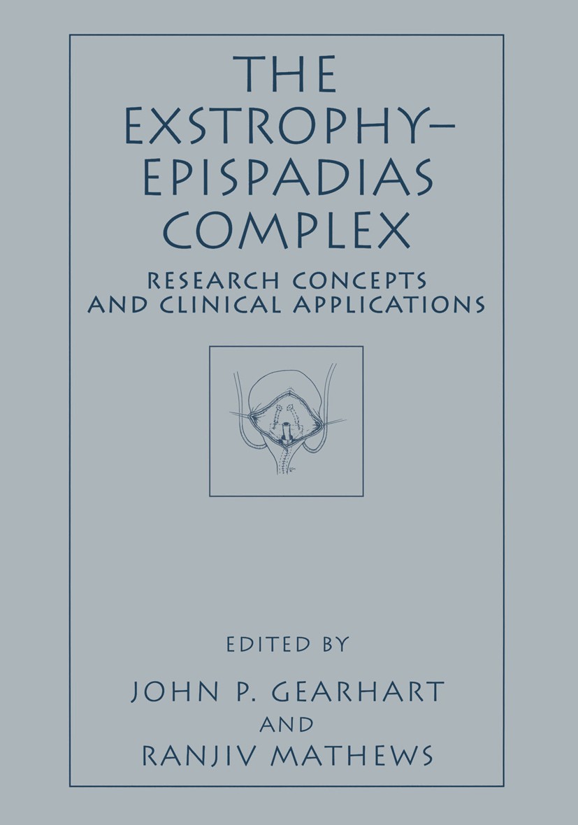 Titlebook: The Exstrophy—Epispadias Complex; Research Concepts an John P. Gearhart,Ranjiv Mathews Book 1999 Springer Science+Business Media New York 1 Titlebook: The Exstrophy—Epispadias Complex; Research Concepts an John P. Gearhart,Ranjiv Mathews Book 1999 Springer Science+Business Media New York 1
