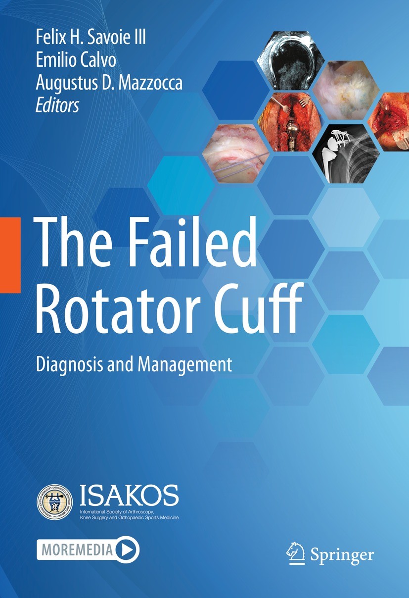 Titlebook: The Failed Rotator Cuff; Diagnosis and Manage Felix H. Savoie III,Emilio Calvo,Augustus D. Mazzo Book 2021 ISAKOS 2021 Rotator cuff Anatomy Titlebook: The Failed Rotator Cuff; Diagnosis and Manage Felix H. Savoie III,Emilio Calvo,Augustus D. Mazzo Book 2021 ISAKOS 2021 Rotator cuff Anatomy