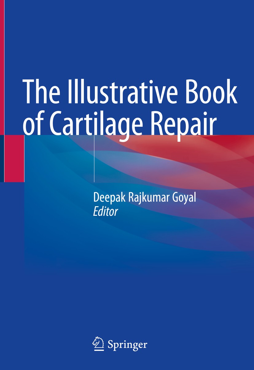 Titlebook: The Illustrative Book of Cartilage Repair; Deepak Rajkumar Goyal Book 2021 Springer Nature Switzerland AG 2021 Arthroscopy.Regenerative me Titlebook: The Illustrative Book of Cartilage Repair; Deepak Rajkumar Goyal Book 2021 Springer Nature Switzerland AG 2021 Arthroscopy.Regenerative me