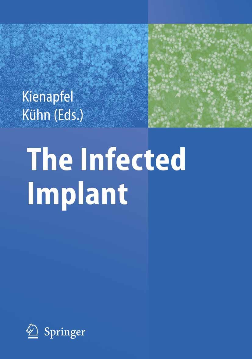 Titlebook: The Infected Implant; Heino Kienapfel,Klaus-Dieter Kühn Book 2009 Springer-Verlag Berlin Heidelberg 2009 antibiotic.antibiotics.antimicrob Titlebook: The Infected Implant; Heino Kienapfel,Klaus-Dieter Kühn Book 2009 Springer-Verlag Berlin Heidelberg 2009 antibiotic.antibiotics.antimicrob