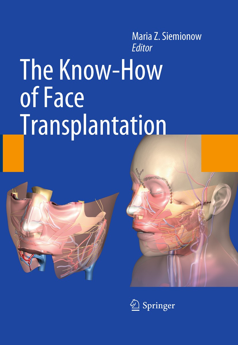 Titlebook: The Know-How of Face Transplantation; Maria Z. Siemionow Book 2011 Springer-Verlag London Limited 2011 Face Transplant.Surgery Titlebook: The Know-How of Face Transplantation; Maria Z. Siemionow Book 2011 Springer-Verlag London Limited 2011 Face Transplant.Surgery