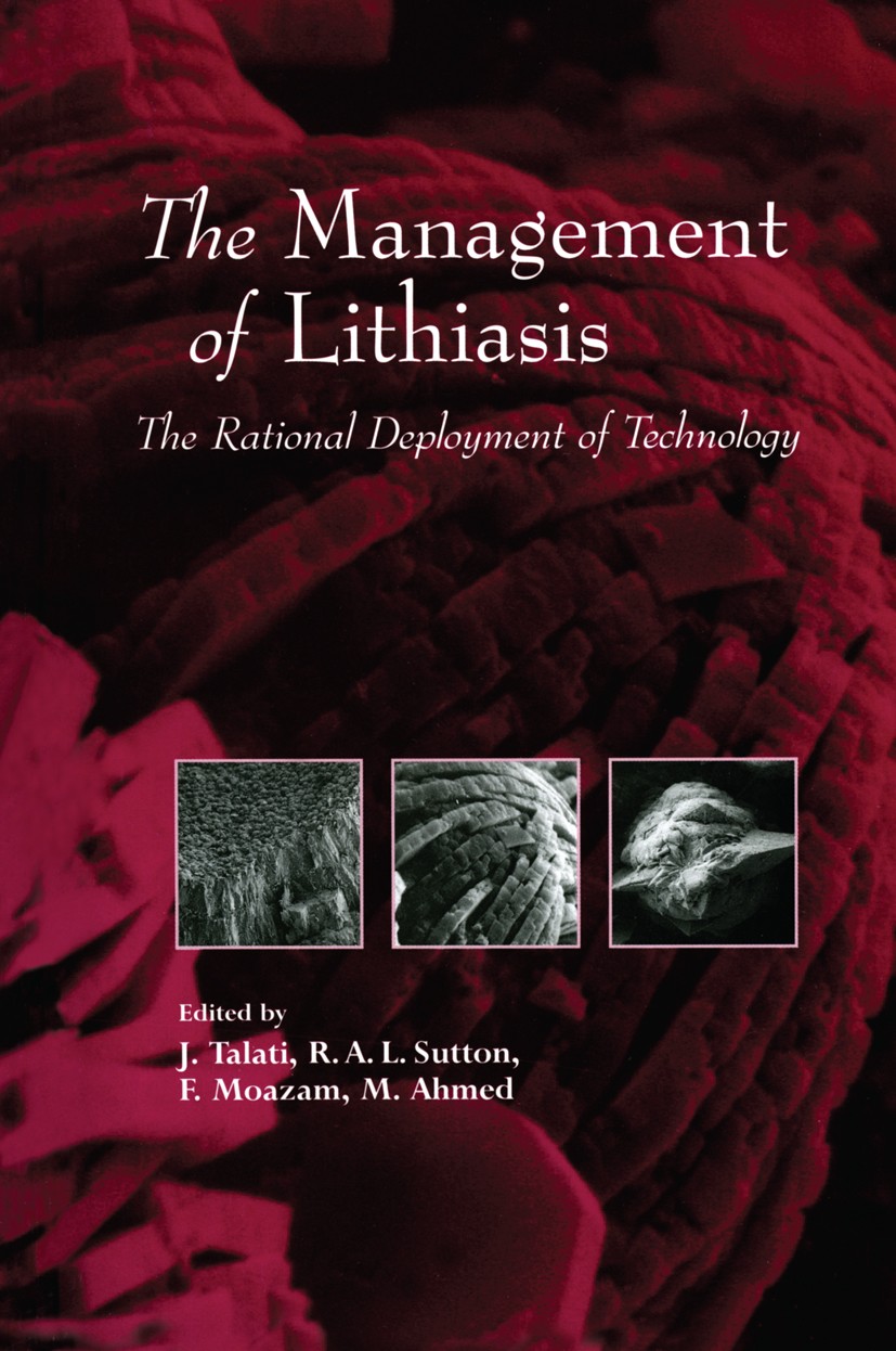 Titlebook: The Management of Lithiasis; The Rational Deploym Jamsheer Talati,Roger A. L. Sutton,Mushtaq Ahmed Book 1997 Springer Science+Business Medi Titlebook: The Management of Lithiasis; The Rational Deploym Jamsheer Talati,Roger A. L. Sutton,Mushtaq Ahmed Book 1997 Springer Science+Business Medi