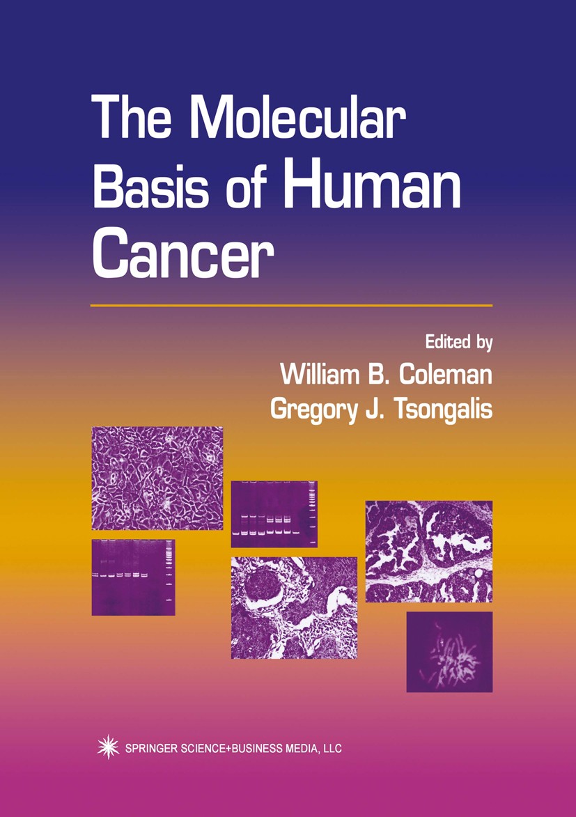Titlebook: The Molecular Basis of Human Cancer; William B. Coleman,Gregory J. Tsongalis Book 20021st edition Springer Science+Business Media New York Titlebook: The Molecular Basis of Human Cancer; William B. Coleman,Gregory J. Tsongalis Book 20021st edition Springer Science+Business Media New York