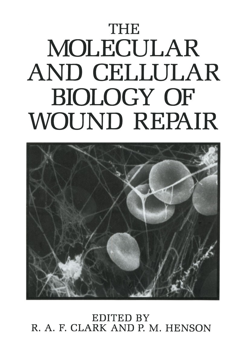 Titlebook: The Molecular and Cellular Biology of Wound Repair; R. A. F. Clark,P. M. Henson Book 1988 Springer Science+Business Media New York 1988 ac Titlebook: The Molecular and Cellular Biology of Wound Repair; R. A. F. Clark,P. M. Henson Book 1988 Springer Science+Business Media New York 1988 ac