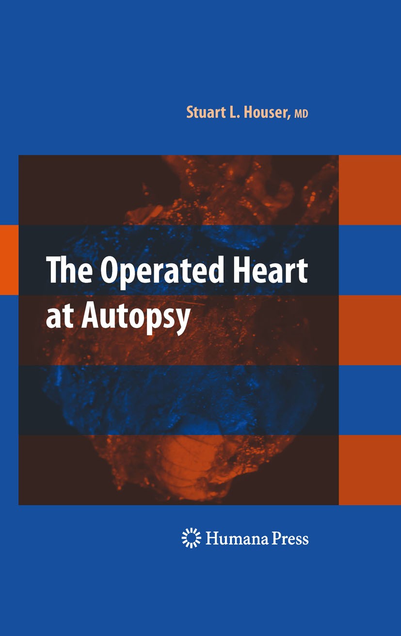 Titlebook: The Operated Heart at Autopsy; Stuart Lair Houser Book 2009 Humana Press 2009 Autopsy.Bypass.congenital heart disease.heart.identification Titlebook: The Operated Heart at Autopsy; Stuart Lair Houser Book 2009 Humana Press 2009 Autopsy.Bypass.congenital heart disease.heart.identification
