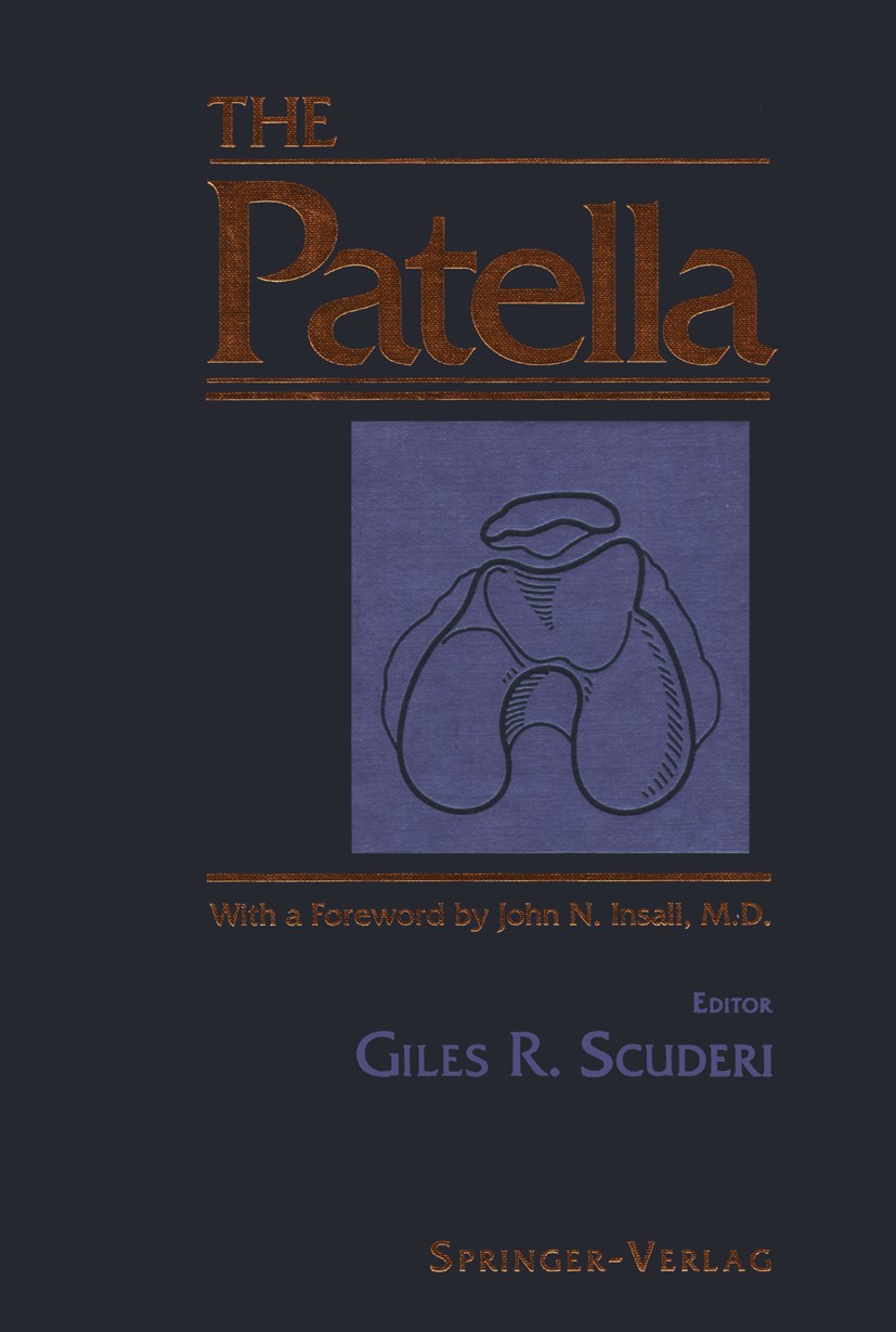Titlebook: The Patella; Giles R. Scuderi Book 1995 Springer-Verlag New York Inc. 1995 Surgery.anatomy.biomechanics.complication.embryology.instabilit Titlebook: The Patella; Giles R. Scuderi Book 1995 Springer-Verlag New York Inc. 1995 Surgery.anatomy.biomechanics.complication.embryology.instabilit