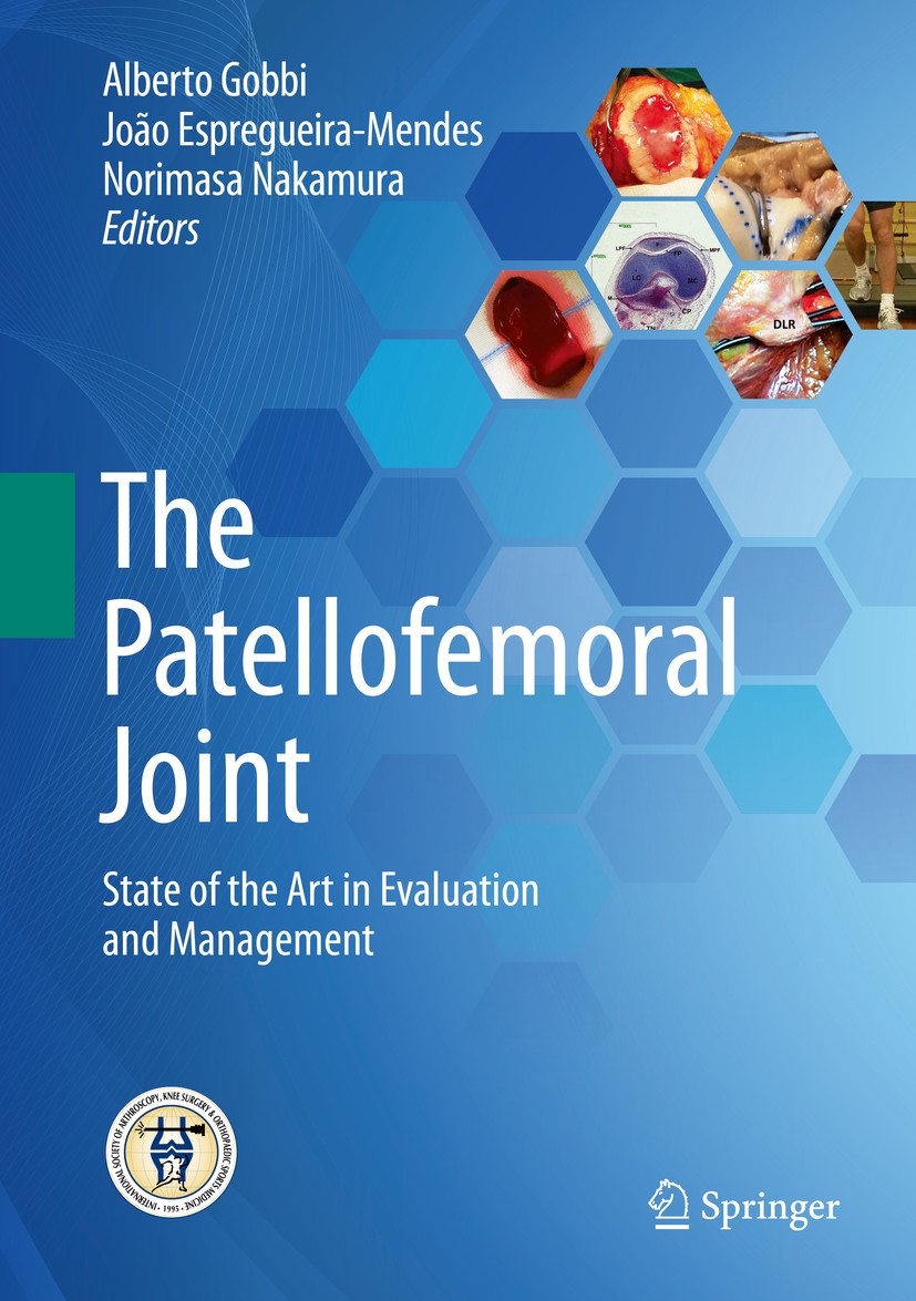 Titlebook: The Patellofemoral Joint; State of the Art in Alberto Gobbi,João Espregueira-Mendes,Norimasa Nak Book 2014 Springer-Verlag GmbH Germany, p Titlebook: The Patellofemoral Joint; State of the Art in Alberto Gobbi,João Espregueira-Mendes,Norimasa Nak Book 2014 Springer-Verlag GmbH Germany, p